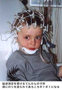脳波測定を受けるてんかんの子供　頭に糊を塗られてあちこちギトギトになる