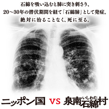 石綿は肺に吸い込むと、長い潜伏期間の末、肺ガンや中皮腫を発症。絶対に治ることはなく、死に至る