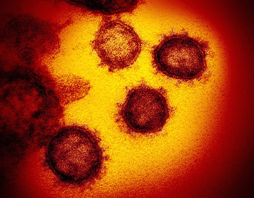 新型コロナウイルス「SARS-CoV-2」の顕微鏡写真
